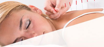 Acupuncture Can Improve your Health